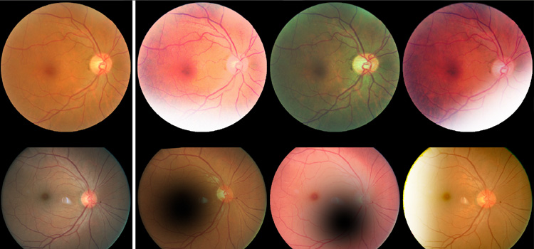 Vue au microscope d'embryons
